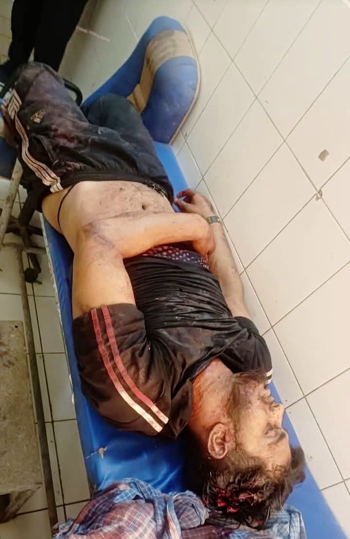 गाजीपुर में बेखौफ अपराधी: शंकर पांडेय की तलाश के बीच दिनदहाड़े अजय यादव की हत्या, 11 नामजद समेत दर्जनों पर मुकदमा दर्ज